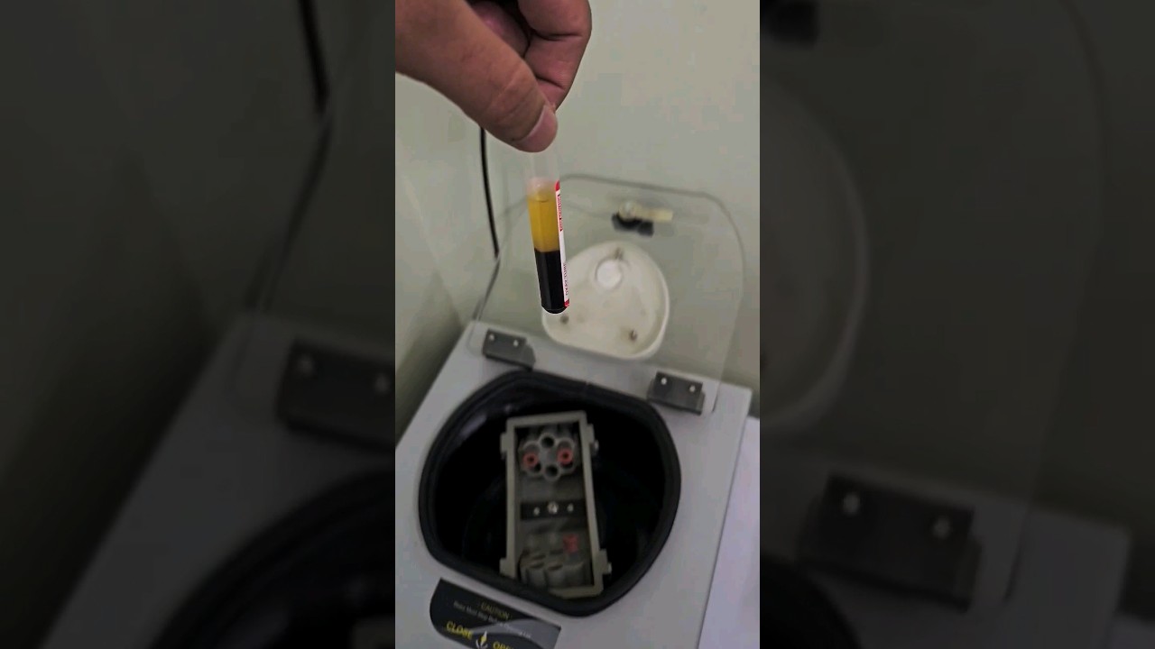 blood plasma separation process  #shorts #centrifuge