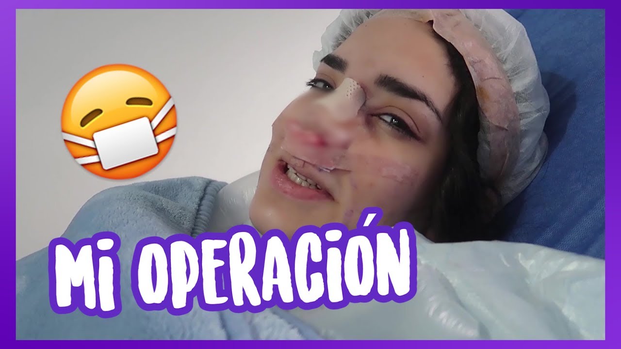 ME OPERÉ LA NARIZ Y... 😷 Kimberly Loaiza