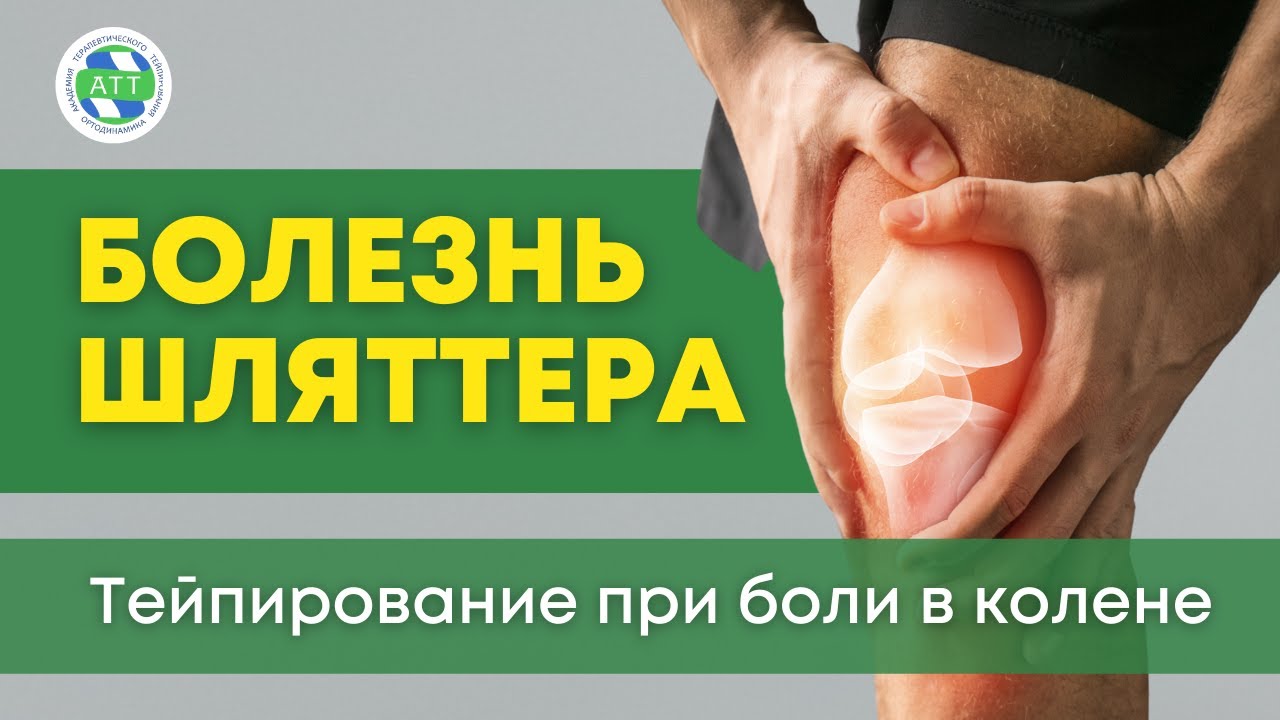 Болезнь Шляттера. Тейпирование колена