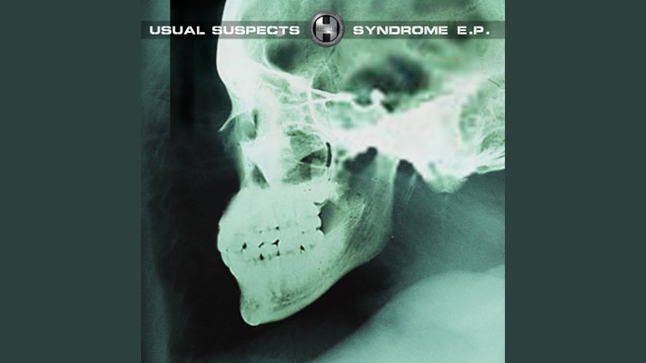 Shrapnel (Stakka & Skynet Remix)
