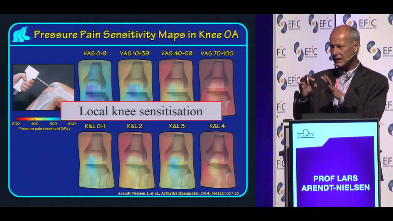 Chronic severe osteoarthritis pain