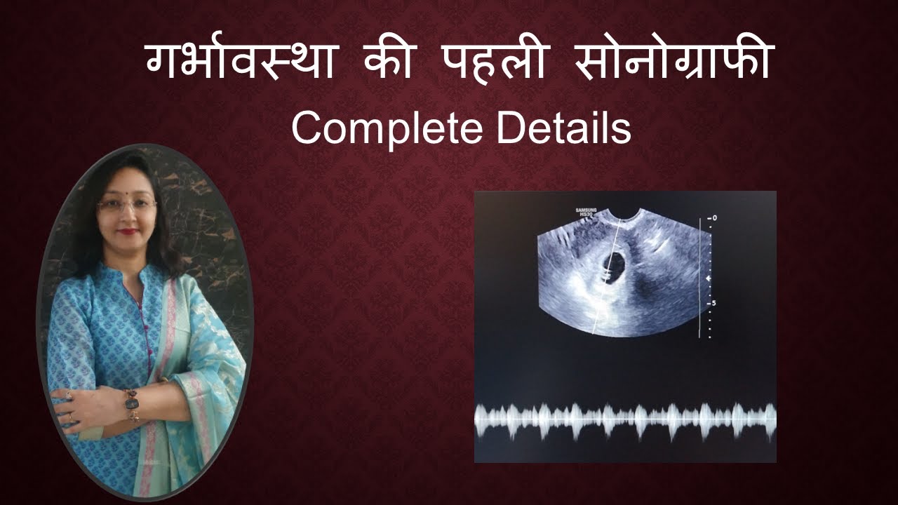 गर्भावस्था की पहली सोनोग्राफी / First Ultrasound Of Pregnancy /Gestational Sac /CRL /CardiacActivity