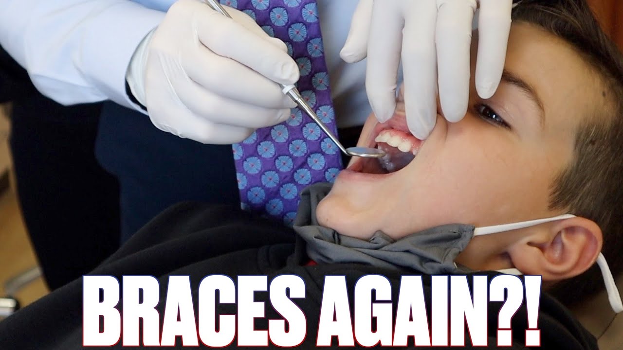 GETTING BRACES AGAIN?! GETTING BRACES FOR THE SECOND TIME