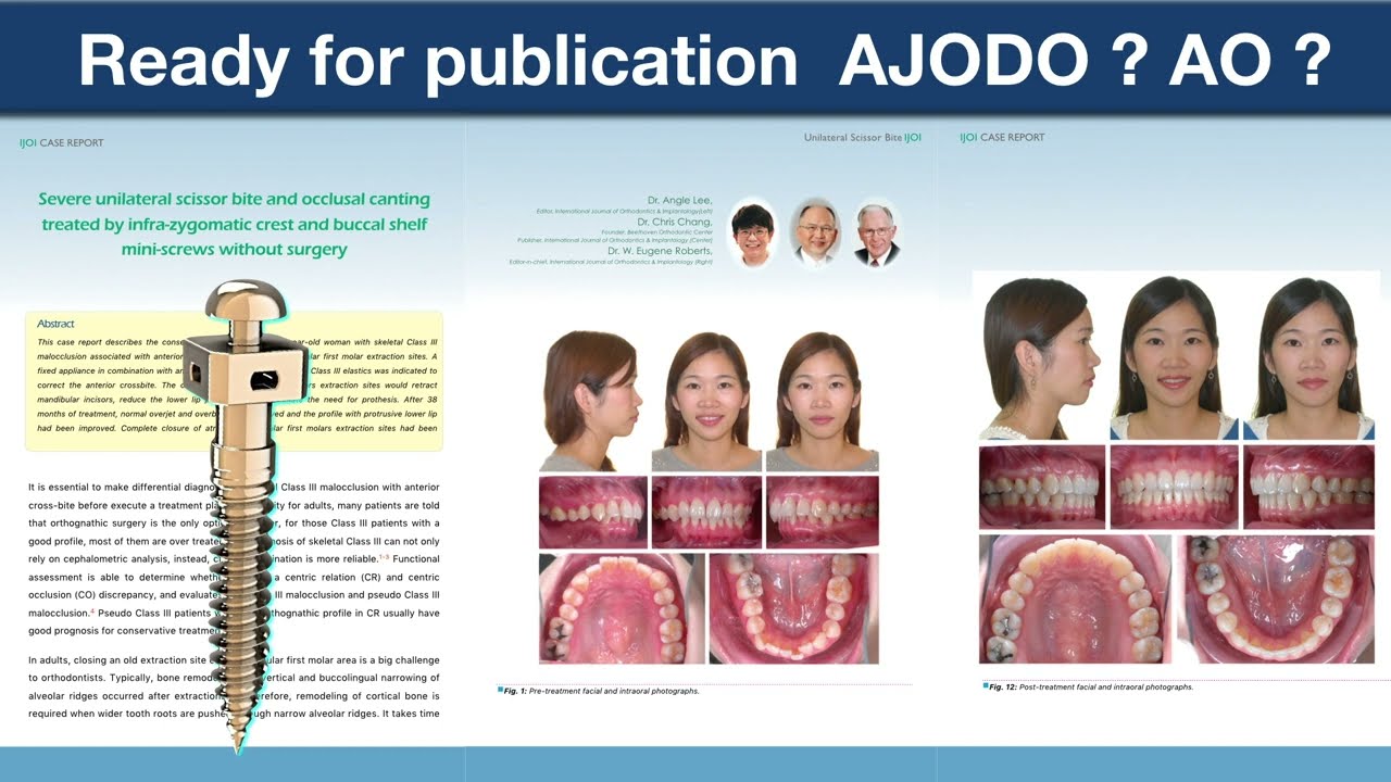 CC379  American Association of Orthodontists AAO 2016 Chris Part 7