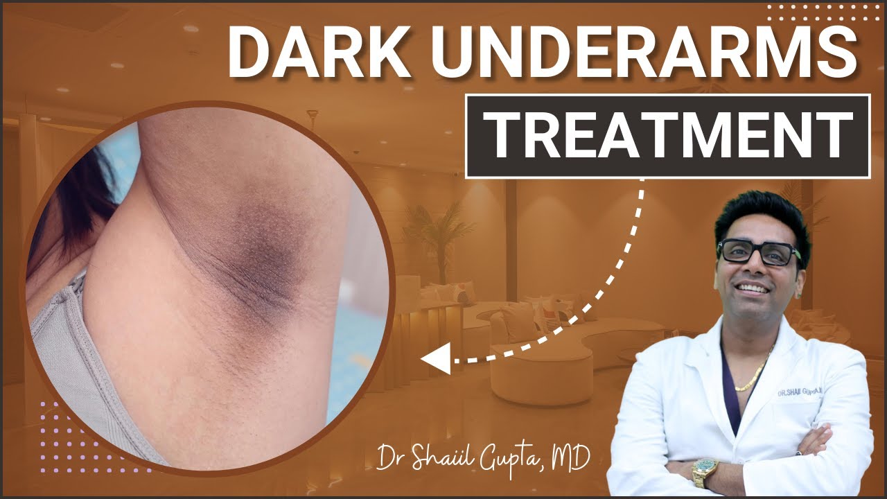 Dark Underarms Treatment | Black Underarms Laser Treatment | Dark Underarm Problem | Dark Underarms