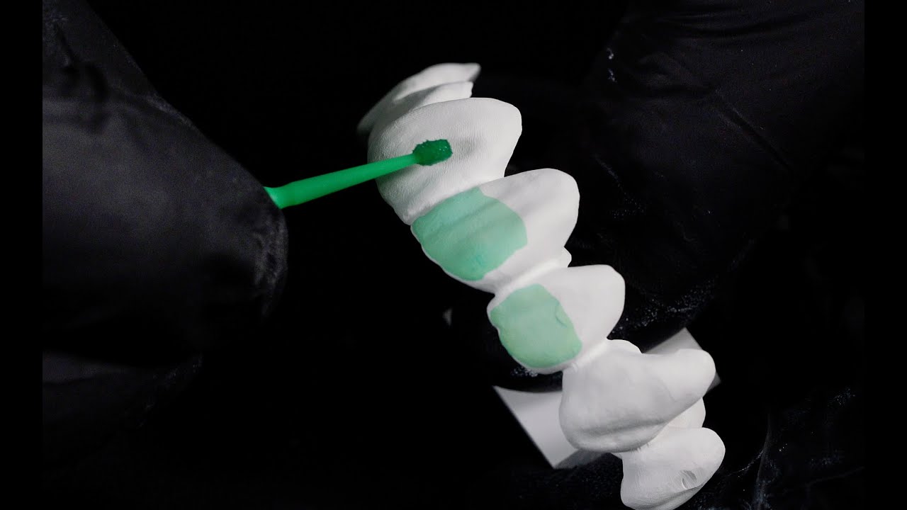 DD IncisalX-Liquid Anwendervideo