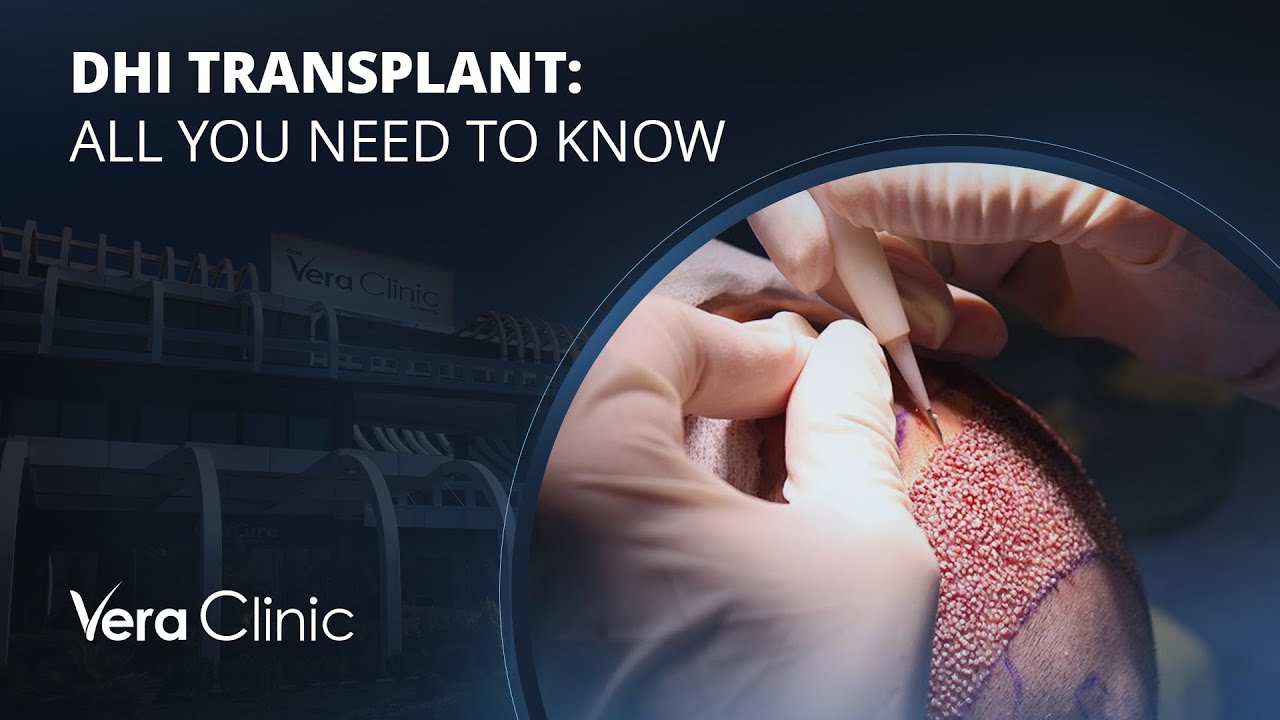 Mastering DHI Hair Transplantation: Everything You Need to Know