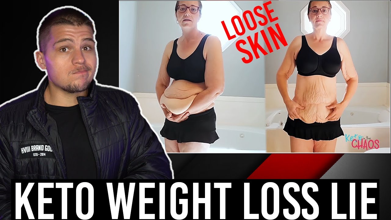 The SHOCKING Truth About KETO & Weight Loss