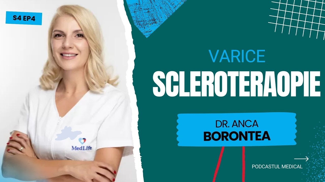 VARICE & SCLEROTERAPIE | Dr. Anca Borontea (Chirurgie Vasculara)