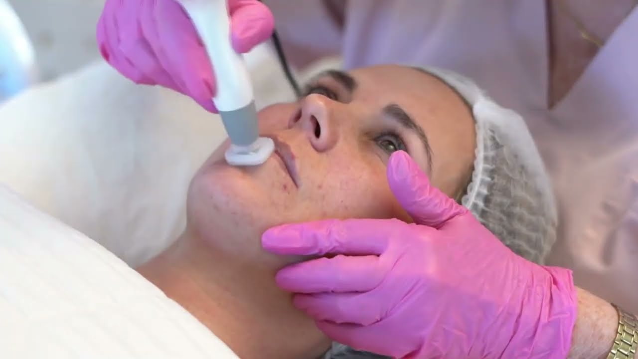 Jet Plasma 🚀Advanced Skin Tightening Technology