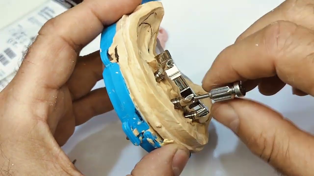 barra su impianti dentali