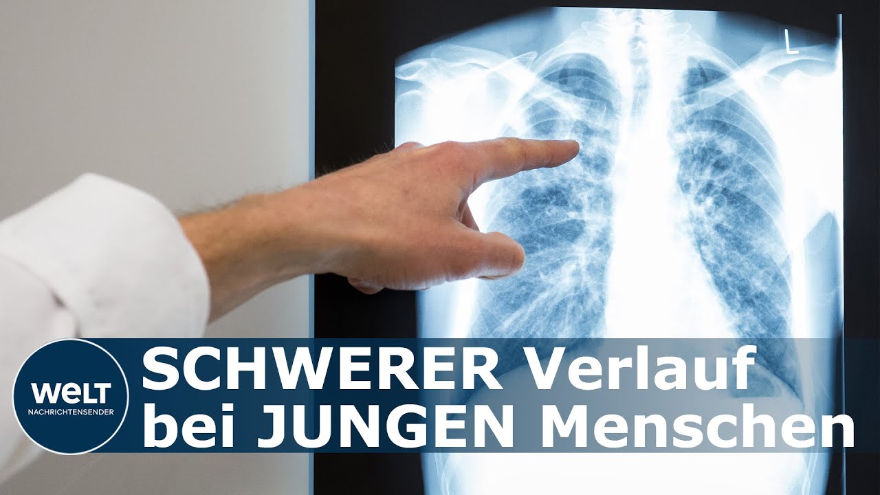 SCHWERER CORONA-VERLAUF: Diese junge Patientin erzählt - So heftig ist Covid-19 wirklich
