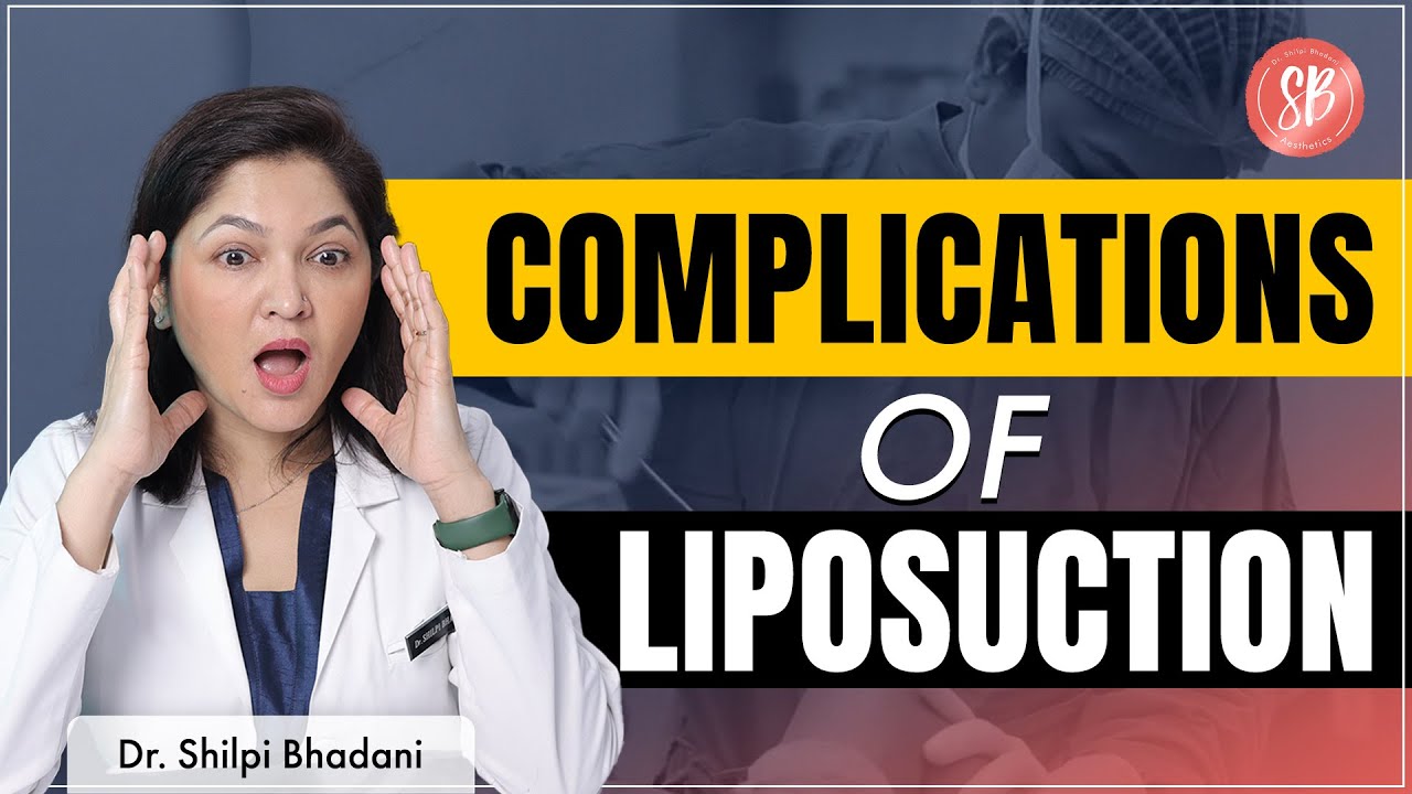 Liposuction side effects | Liposuction Surgery in Gurgaon | SB Aesthetics | Dr Shilpi Bhadani