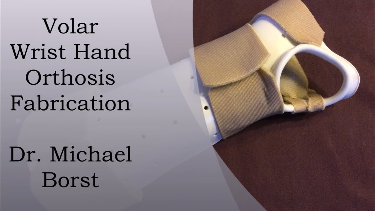 Volar Wrist Hand Orthosis Fabrication Demonstration