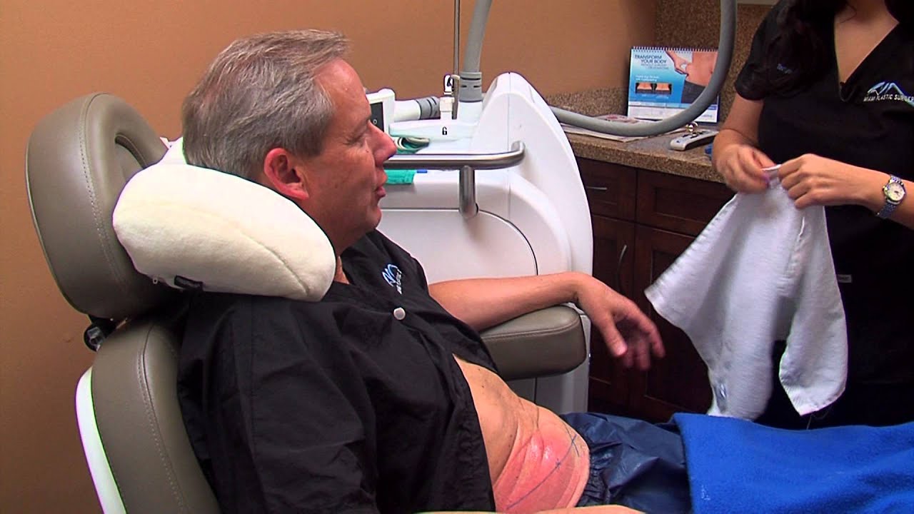 Miami Plastic Surgery - My Cool Experience with CoolSculpting