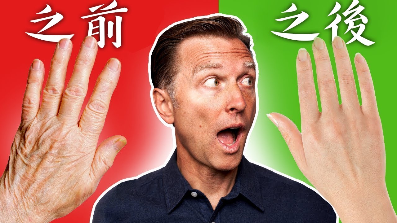 皺紋皮膚乾燥,用玻尿酸保濕,自然療法,柏格醫生 Dr Berg