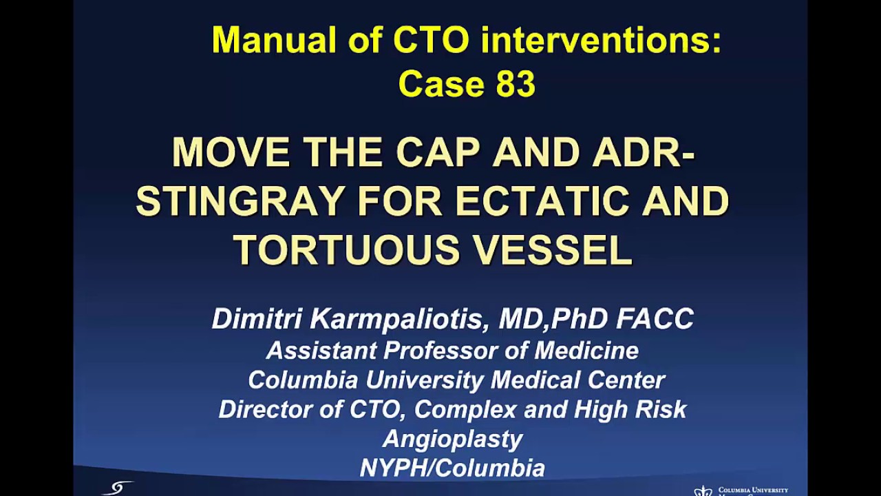 Case 83: Manual of CTO Interventions: - Move the cap and ADR for ectatic and tortuous vessel