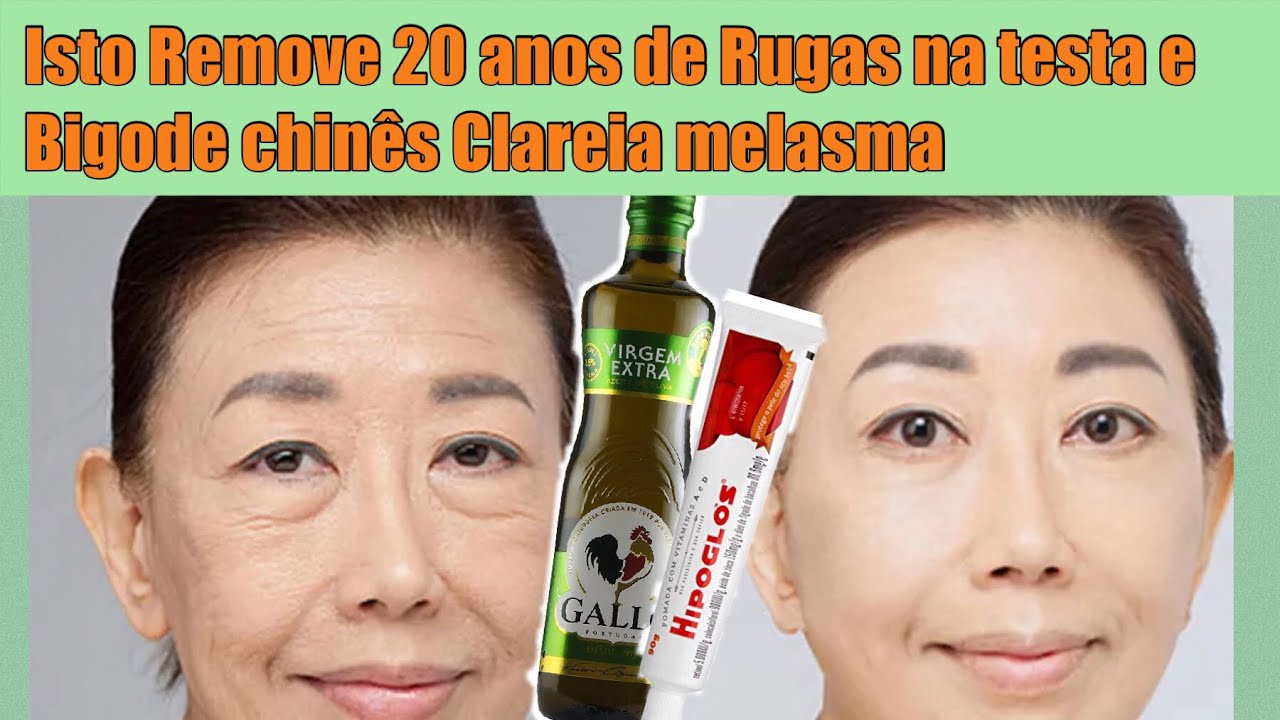 ISTO REMOVE 20 ANOS DE RUGAS NA TESTA E BIGODE Chin&ecirc;s CLAREIA MELASMA