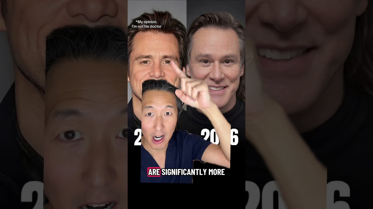 Did Jim Carrey Get a Bunch of Plastic Surgery?