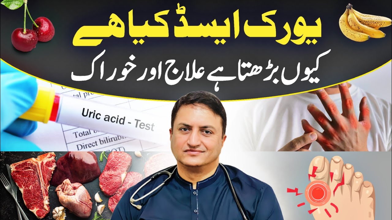 Uric Acid kya hai? Kyun barhta hai? Ilaj aur khoraak