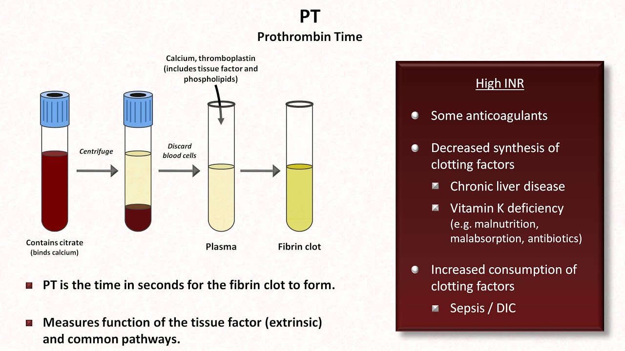 Hemostasis: Lesson 4 - Tests (INR, PTT, platelets, fibrinogen, D-dimer)