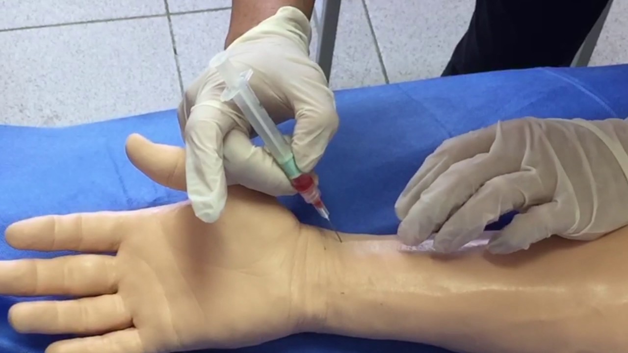 Extracción de Sangre Arterial