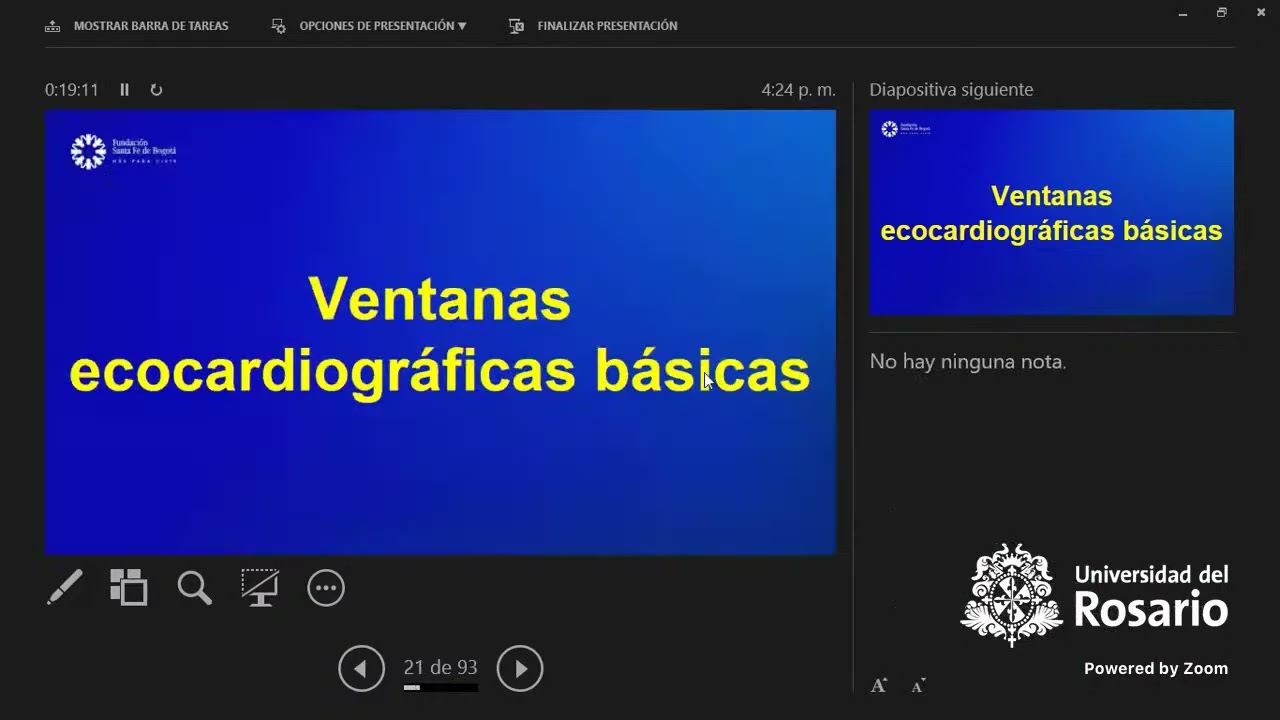 Ecocoardiografía básica