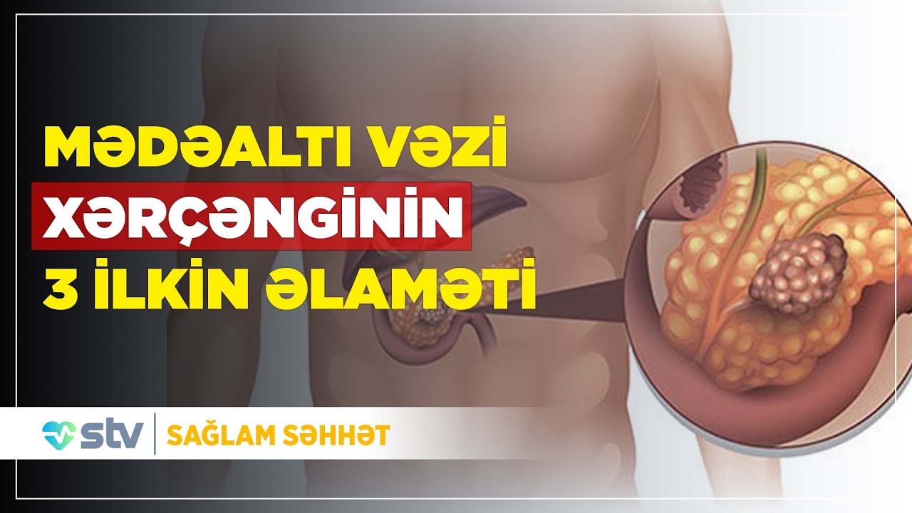 Mədəaltı vəzin xərçəngi niyə yaranır? - Sağlam Səhhət (24.07.2024)