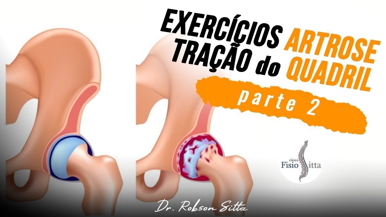 ARTROSE de QUADRIL EXERCÍCIO de TRAÇÃO LATERAL COM CINTO no ALÍVIO da DOR Clínica Dr. Robson Sitta ®