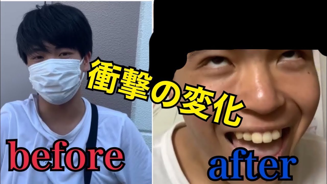 【4年前】毎日投稿ルール破ったので坊主になってしまいました。