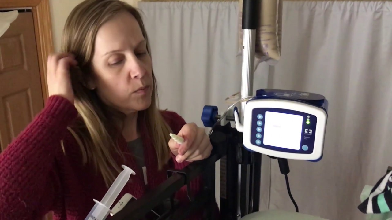 Managing Faith's NG feedings