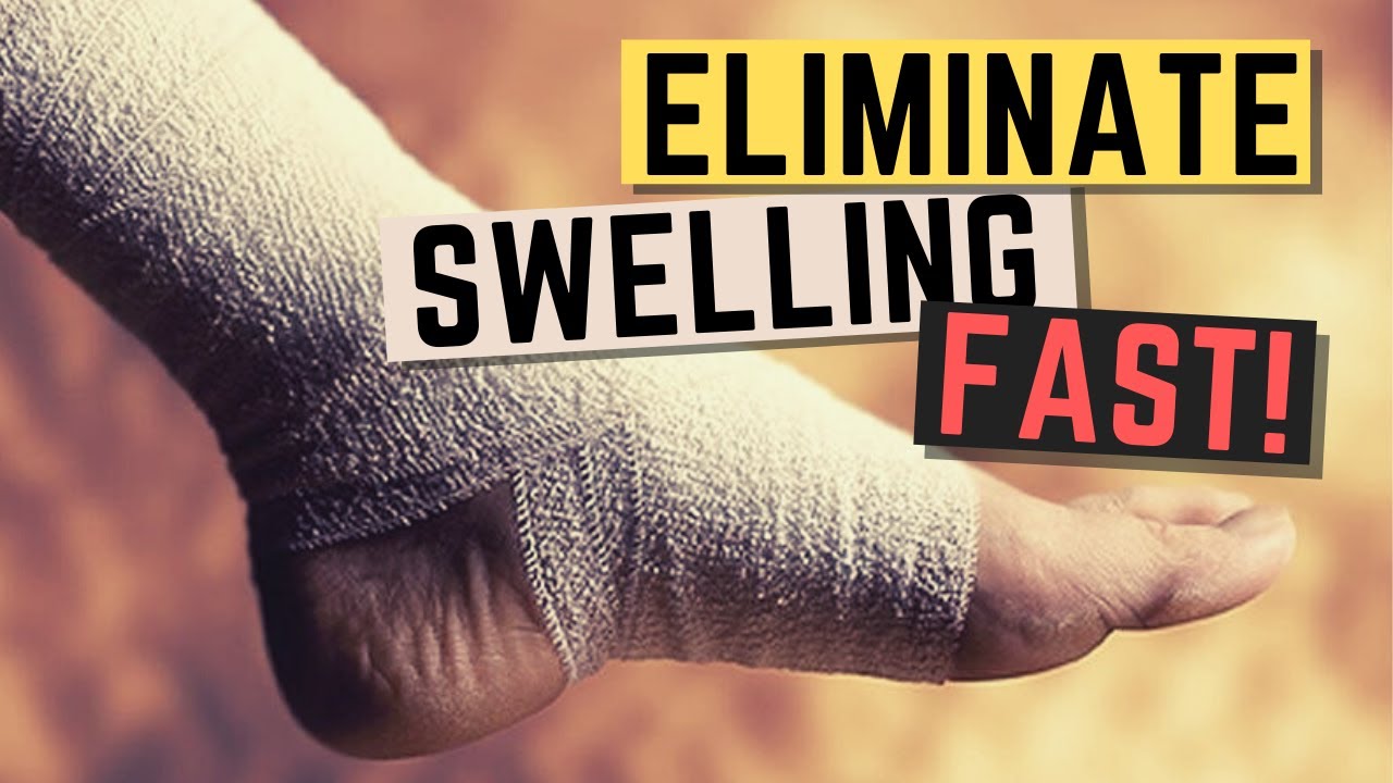 How to Quickly Reduce Swelling WITHOUT R.I.C.E
