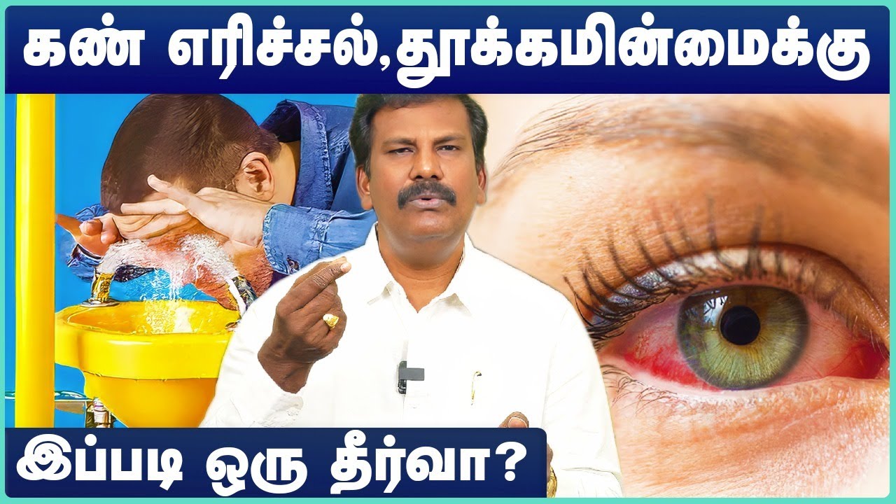 கண் எரிச்சல் அதிகமாக இருக்கா? | Burning eyes: Causes and home remedies | Dr.Akshayan |Cosmo Health