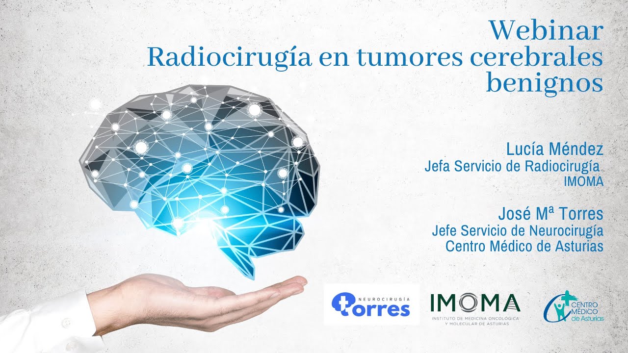 Radiocirugía en tumores cerebrales benignos