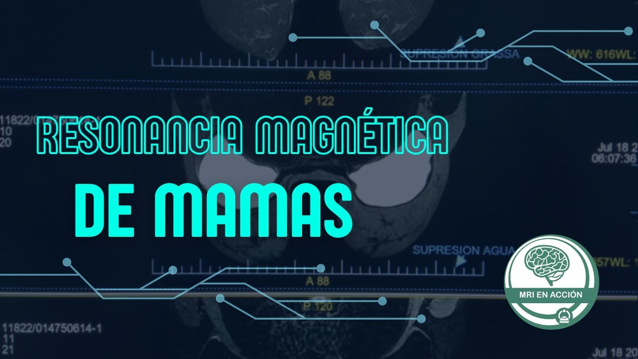 RESONANCIA MAGNÉTICA DE MAMAS PASO A PASO