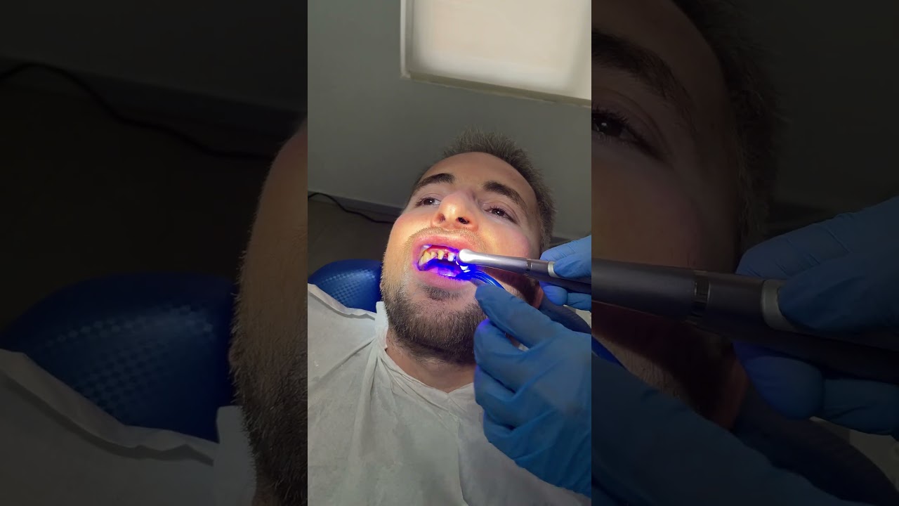 Printing New Teeth with 3D Printer (CEREC)