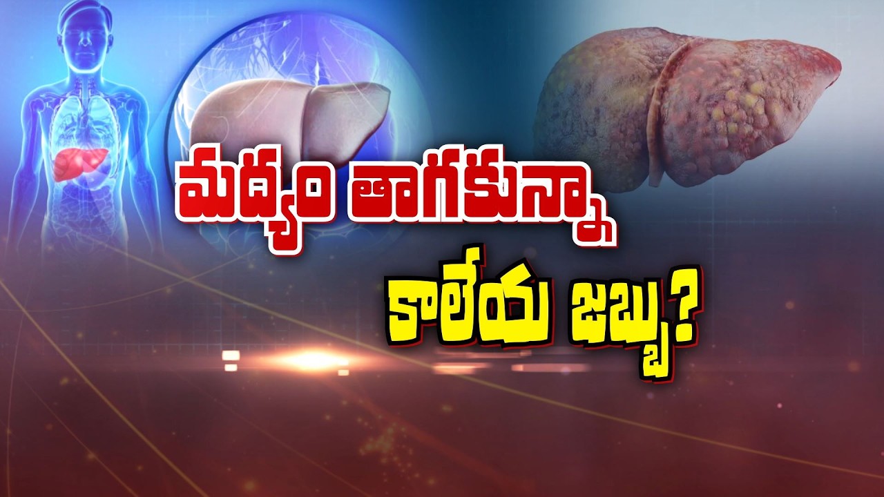 మద్యం తాగకున్నా కాలేయ జబ్బు? |Liver disease event without drinking Alcohol | Sukhibhava | 19th Feb26