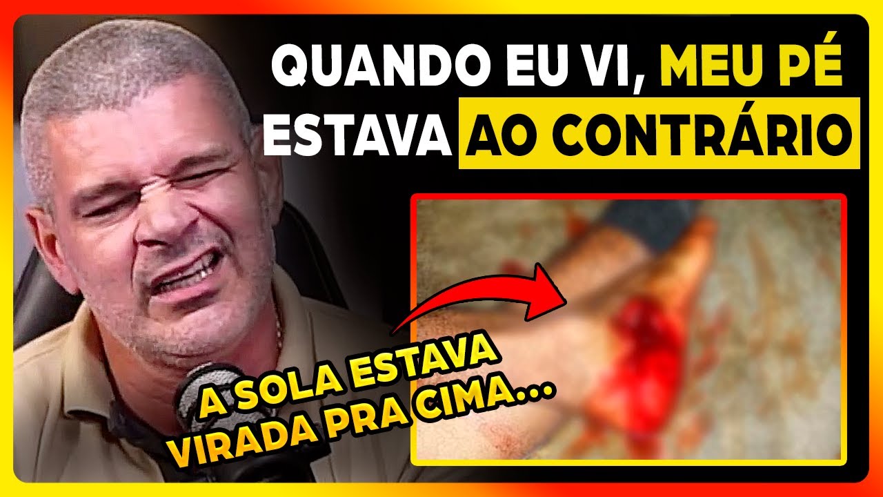 PM DO BOPE REVELA DETALHES DE COMO PERDEU SEU PÉ...