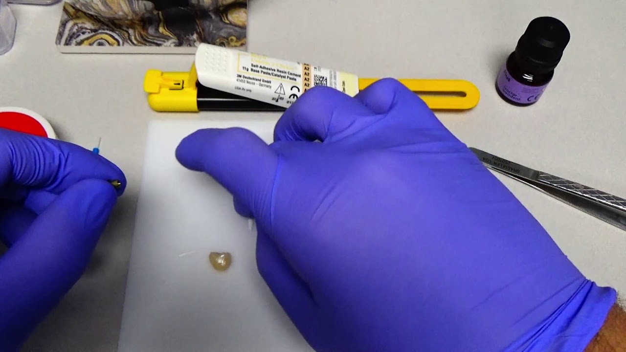 Cementing Titanium Bases to Implant Crowns (Zirconia or Lithium Disilicate)
