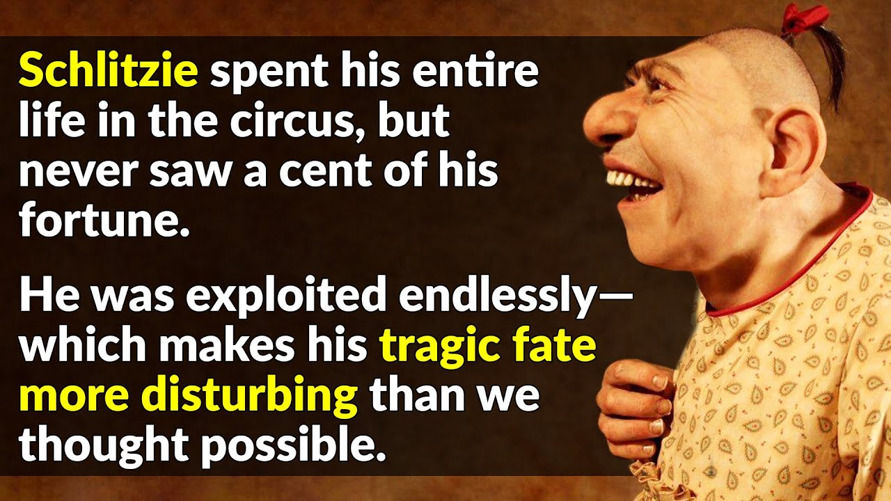 The Heartbreaking Story Of Schlitzie The Pinhead