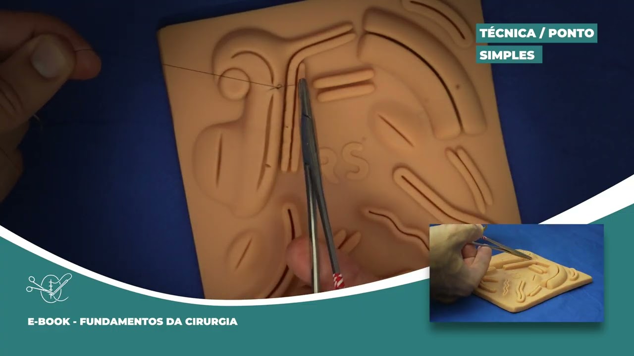 SUTURA PONTO SIMPLES - Como fazer!!