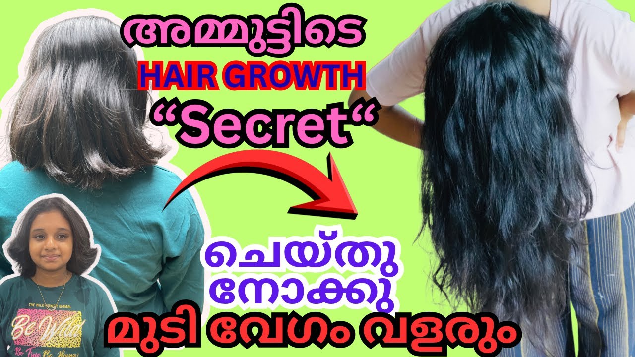 ഇതൊരു “എളുപ്പപണി“ആണ് പക്ഷെ മുടി വേഗം വളരും ✌️ 💯 working ആണ് മുടി വളരും ഉള്ളോടെ #haircare 