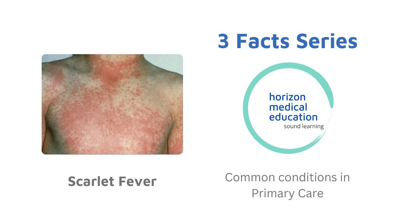 #scarletfever #childhoodillness #streptococcus #3facts #rashes