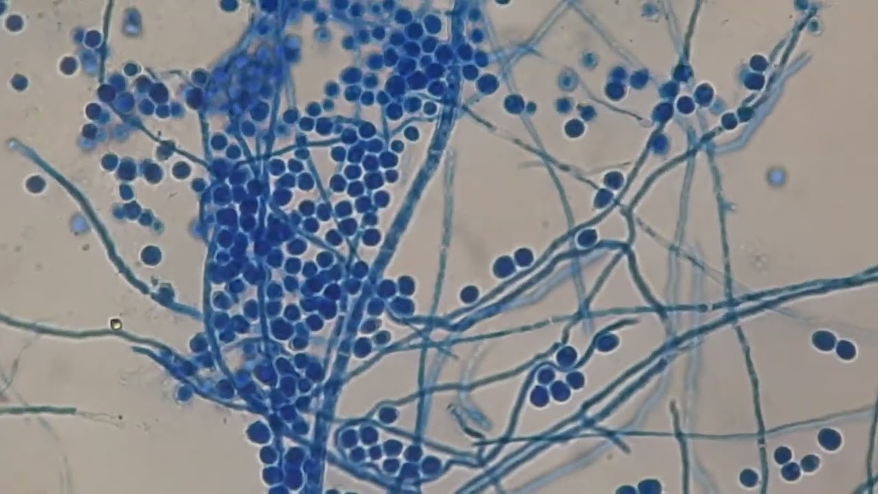 Conidia and hyphae of Aspergillus in LPCB of Cornmeal agar