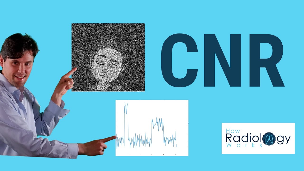 Contrast to Noise Ratio (with graphical example for Rad Techs)
