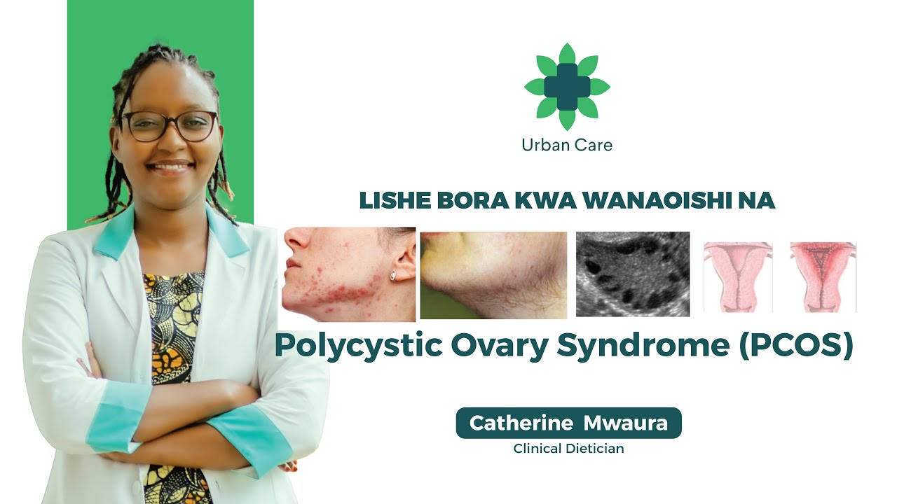 PCOS: Tatizo linalotesa WANAWAKE, kuwapa UGUMBA, kuwanenepesha -Zifahamu DALILI na TIBA yake