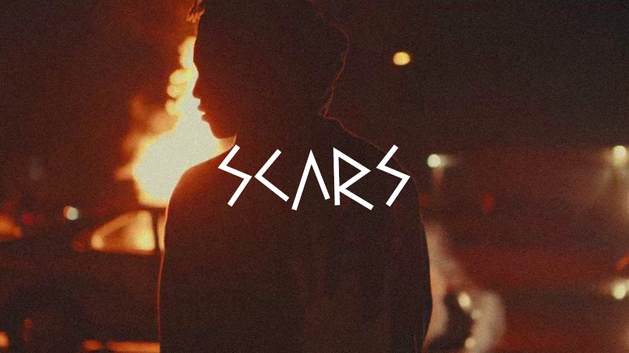 [FREE] XXXTentacion Type Beat - Scars | 