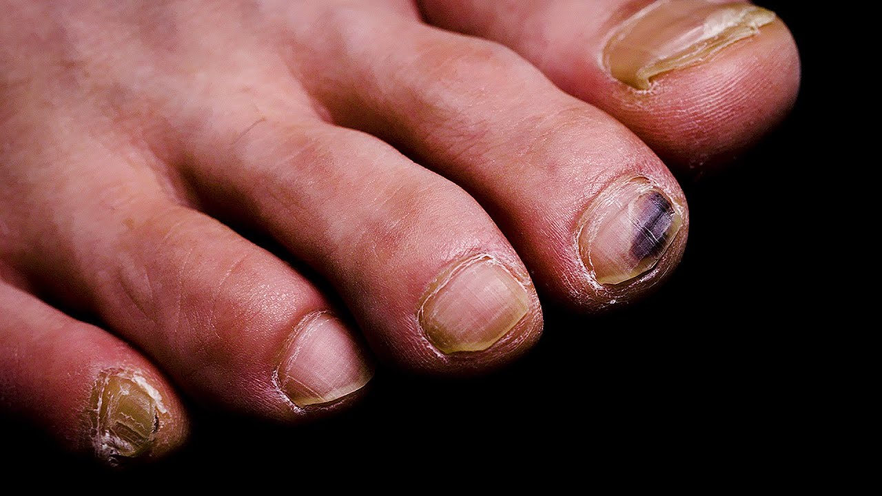 [ASMR] 축구선수 발 페디케어 해주기 |  Nail care ASMR 5