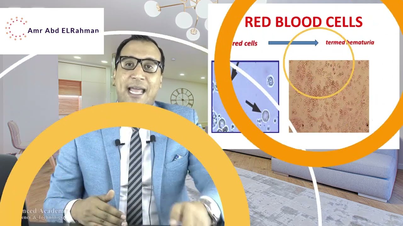 المحاضرة الثانية من تحليل البول الكامل (تشخيص الميكروسكوب) Microscopical Examination of Urine