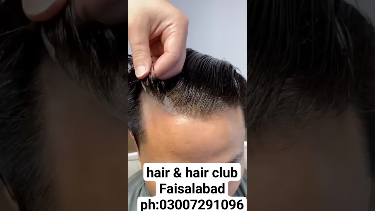 hair replacement #hairclub #hair #hairreplacement